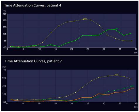 Dynamic Computed Tomography Angiography as Imaging Method for Endoleak ...