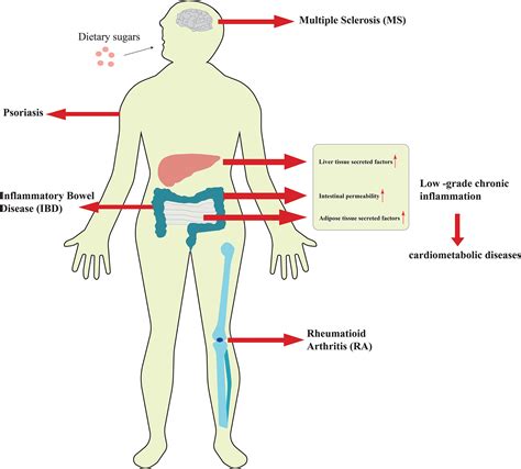 Frontiers | Excessive intake of sugar: An accomplice of inflammation