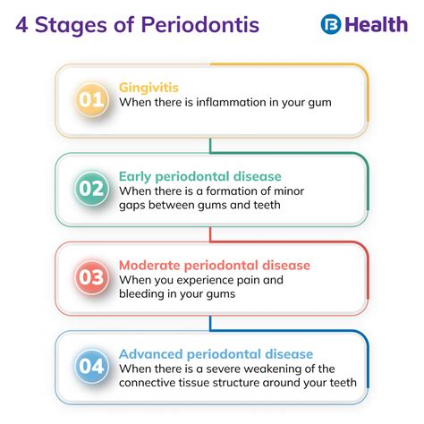 Periodontitis: Causes, Symptoms, Stages and Treatment