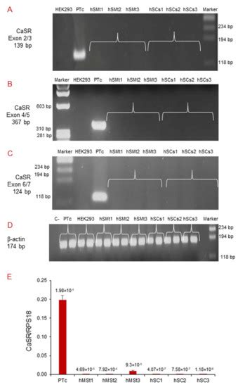 Study of the Expression and Function of Calcium-Sensing Receptor in ...