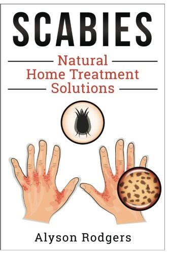 Buy Scabies Natural Home Treatment Solution Book Online at Low Prices ...