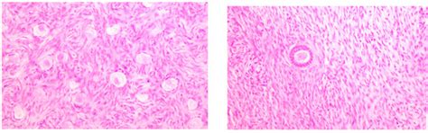 Ovarian Morphometric and Histologic Characteristics and Correlation ...