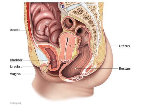 Prolapsed Uterus Stages - stages of vaginal prolapse