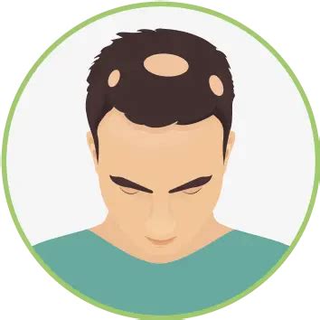 Get Free Hair Diagnosis Online – Personalized Hair Fall Test – Traya