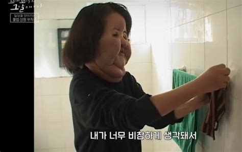 Illegal surgeries drove Han Hye-kyung to self-injection and ...