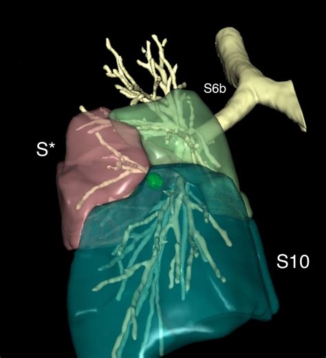 Santiago Figueroa Almánzar on LinkedIn: 3D planning models such as ...