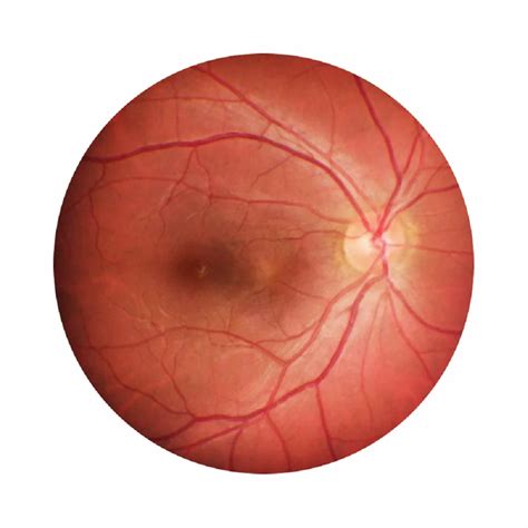 Ophthalmic Equipments & Hospital Furniture - Eye Care Hospital ...