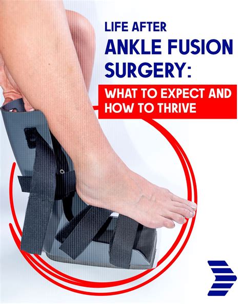 #anklefusionsurgery #anklepainrelief #arizona #podiatrist # ...