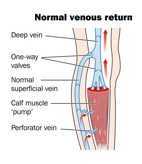 Venous Valves Normal Anatomy at Angeline Barron blog