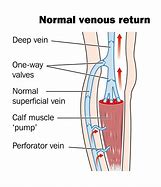 Image result for Venous