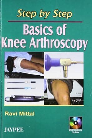 Buy Step by Step Basics of Knee Arthroscopy (with CD ROM) Book Online ...