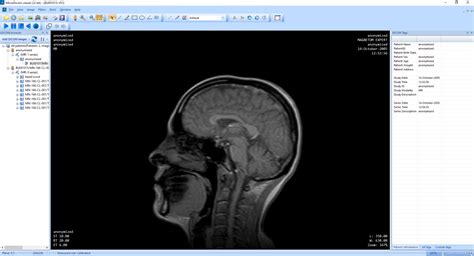 Best dicom viewer for windows 10 - lasopavegan