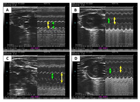 Cyclocreatine Phosphate: A Novel Bioenergetic/Anti-Inflammatory Drug ...