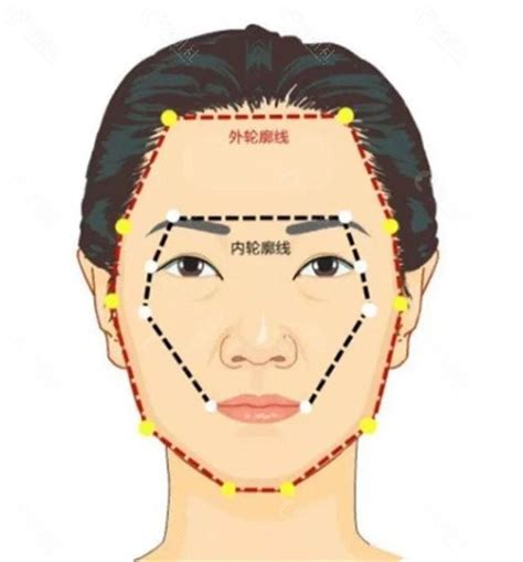 内轮廓/外轮廓区别分享,韩国面部轮廓手术厉害的医院均覆盖 - 爱美容研社