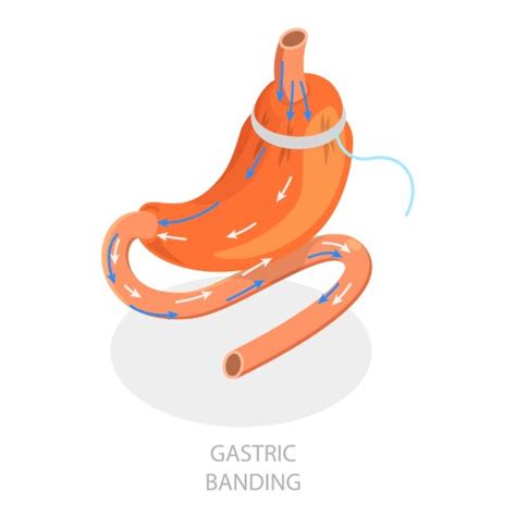 Isometric Types 的图像结果