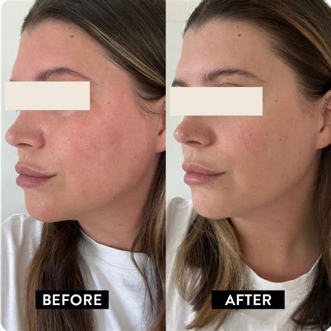 Korean Marine Collagen Peptides | Best Anti-Aging Collagen Supplement ...