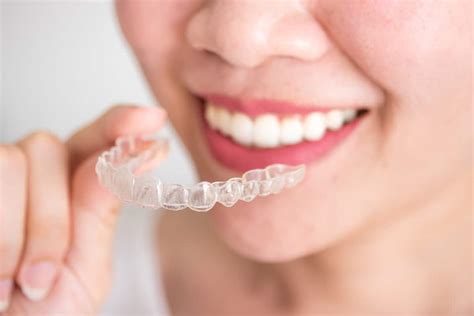 Image result for Invisalign Process