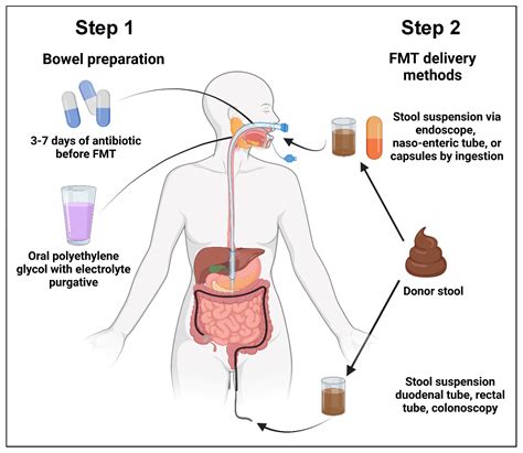 Fecal Microbiota Transplant for Hematologic and Oncologic Diseases: Principle and Practice