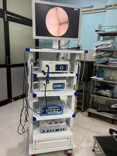 Endoscopy Equipment - Stryker 1488 Hd Camera Manufacturer from Ghaziabad