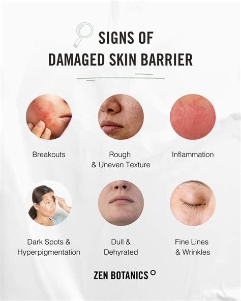 Signs of Damage Skin Barrier | Skin care, Skin facts, Skin care routine