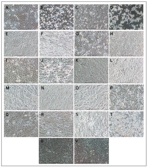 Differential Cell Line Susceptibility to the SARS-CoV-2 Omicron BA.1.1 ...