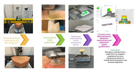 In Vitro Comparison of Monolithic Zirconia Crowns: Marginal/Internal ...