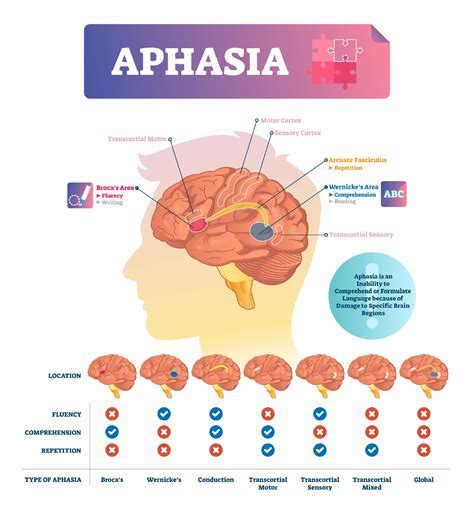 What is Aphasia?