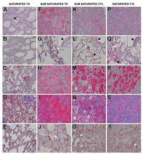 The Therapeutic Monoclonal Antibody Bamlanivimab Does Not Enhance SARS ...