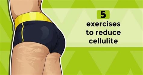 Image result for Exercise to Remove Cellulite That Works Fast
