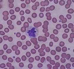 Image result for Monocyte Under Microscope