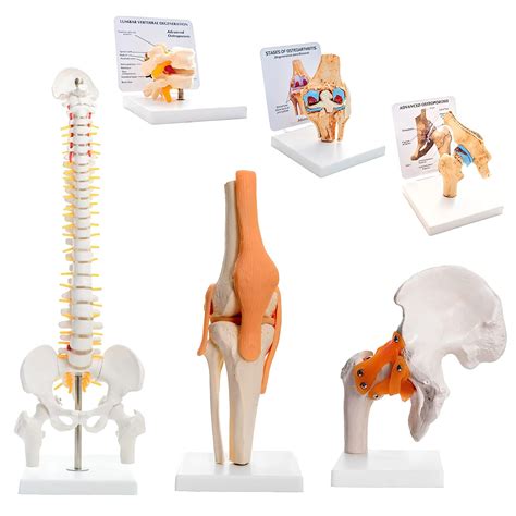 Kay Kay Industries (Set of 6)- 45 cms Spine Model, Life Size Hip Joint ...