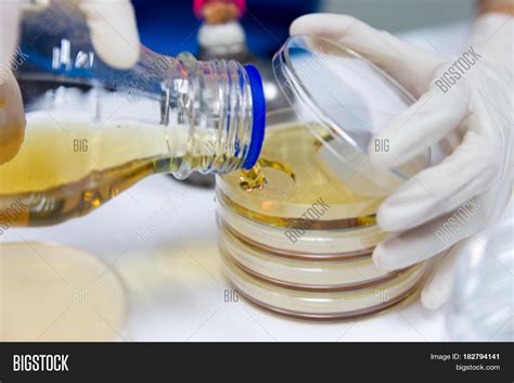 Pour Plate Method Image & Photo (Free Trial) | Bigstock