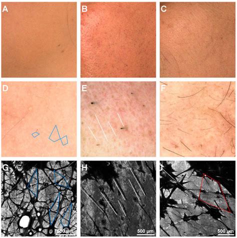 Diagnostics | Special Issue : Non-invasive Diagnosis of Skin Diseases