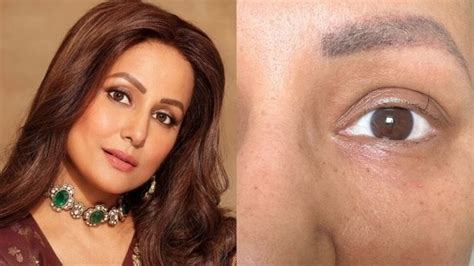 Hina Khan’s Cancer Journey: Finding Hope in One Eyelash - Nakhare
