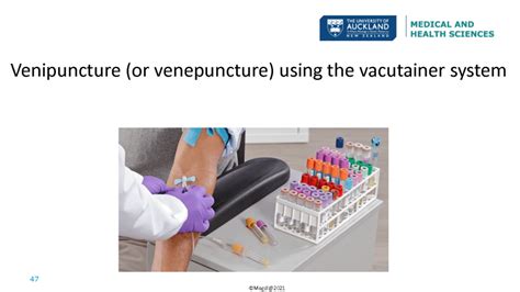 Image result for Learning IV