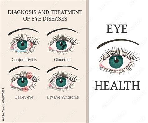 Image result for Common Eye Problems
