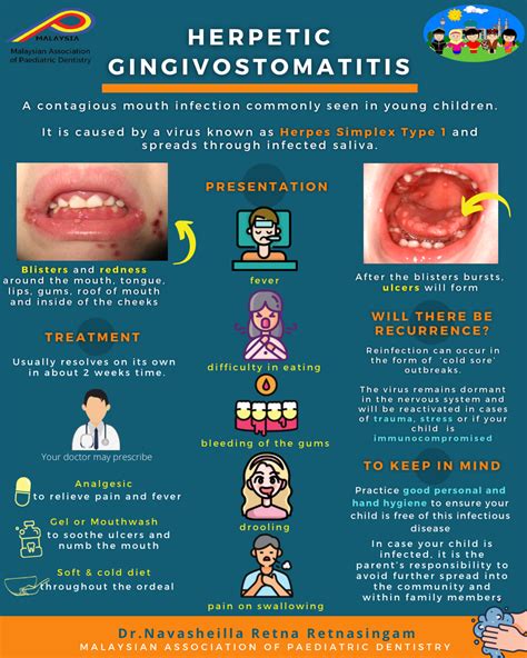 Primary Herpetic Gingivostomatitis
