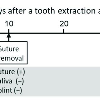 Image result for Tooth Extraction Timeline