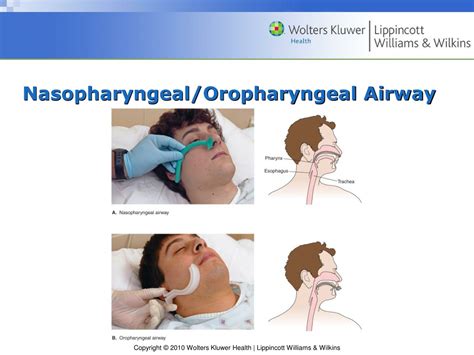 PPT - A Guide on Respiratory Care Disorders and Oxygen Transport PowerPoint Presentation - ID ...