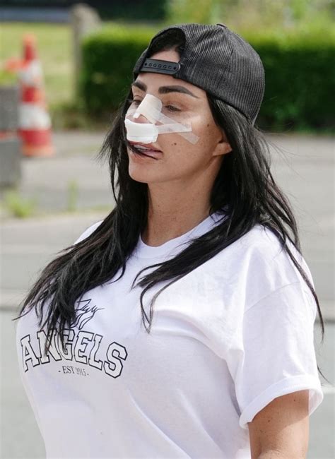 Otečeno lice i glava u zavojima: Pevačica zgrozila fanove FOTO - B92