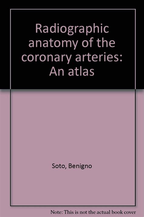 Buy Radiographic anatomy of the coronary arteries: An atlas Online at ...