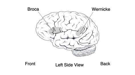 Afasia De Wernicke Afasias De Broca Y Wernicke. Regla Mnemotécnica.