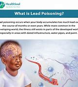 Lead Poisoning 的图像结果