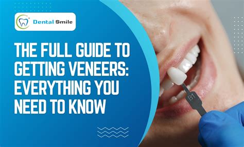 Veneers for Teeth: Complete Guide by Dental Smile Charmhaven
