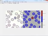 Image result for Medical Image Segmentation MATLAB