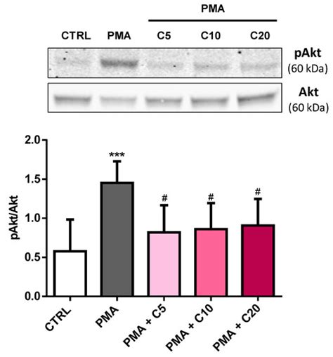 Carnosine Decreases PMA-Induced Oxidative Stress and Inflammation in ...