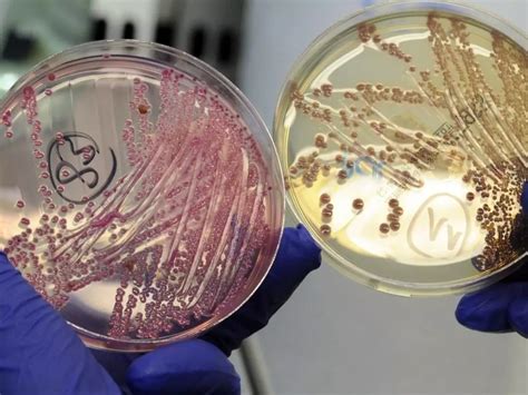 E.coli Bacteria Can Now Eat Carbon Dioxide To Release Biofuel, And Help ...