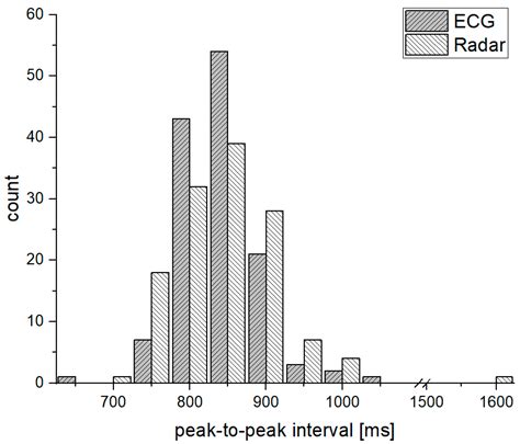 Peak Detection Algorithm for Vital Sign Detection Using Doppler Radar ...