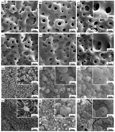 Formation and Bioactivity of Composite Structure with Sr-HA Phase and ...