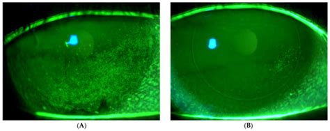 Evaluating Magnetic Stimulation as an Innovative Approach for Treating ...